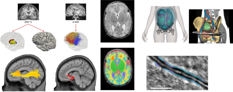 Medical imaging