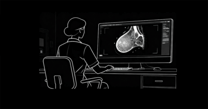 ideas-mammography-news
