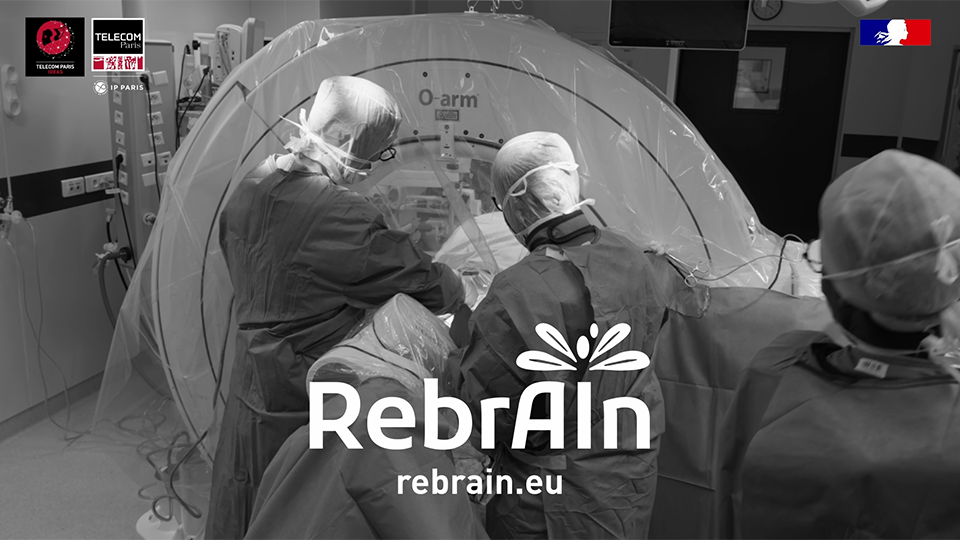 RebrAin, une neurochirurgie plus précise grâce à l'IA (vidéo)